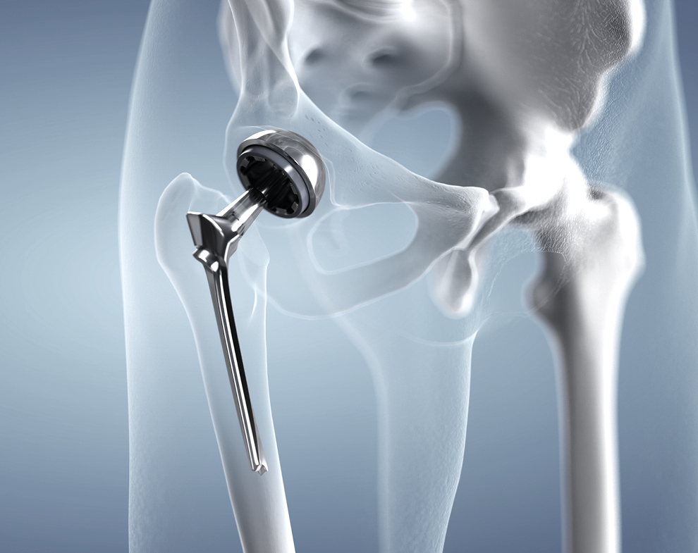 GUE_App_Expertensystem_Branche_Medizintechnik_Orthopaedie